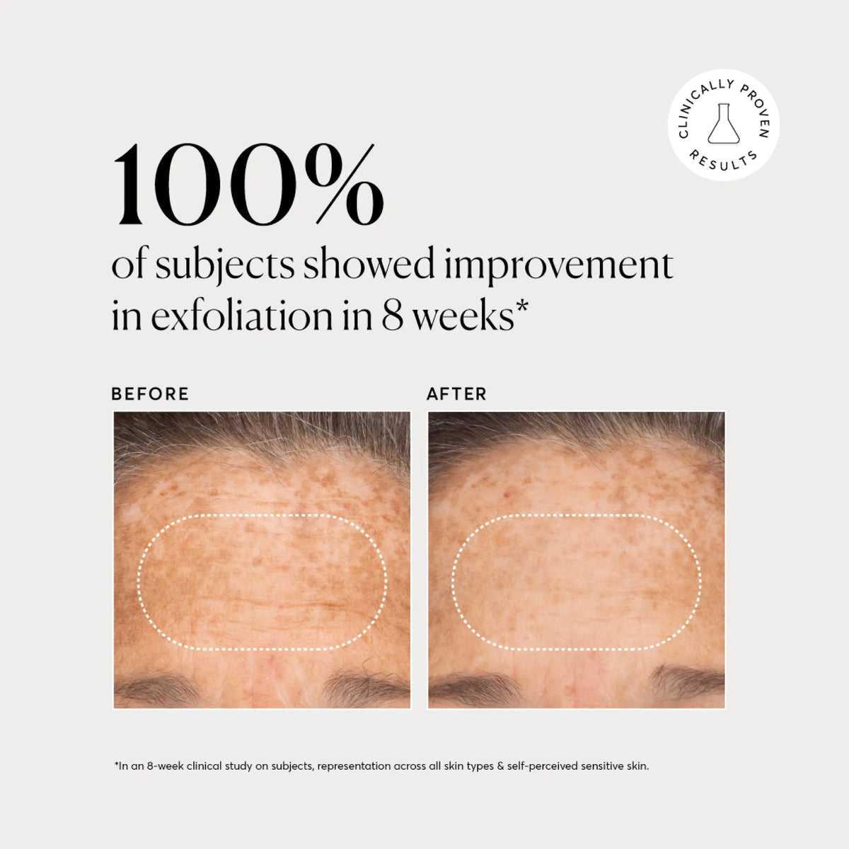 bha-liquid-exfoliant-2-r2 NATR-10027-Alt-Images-BHA-Liquid-Exfoliant-2_-03.webp