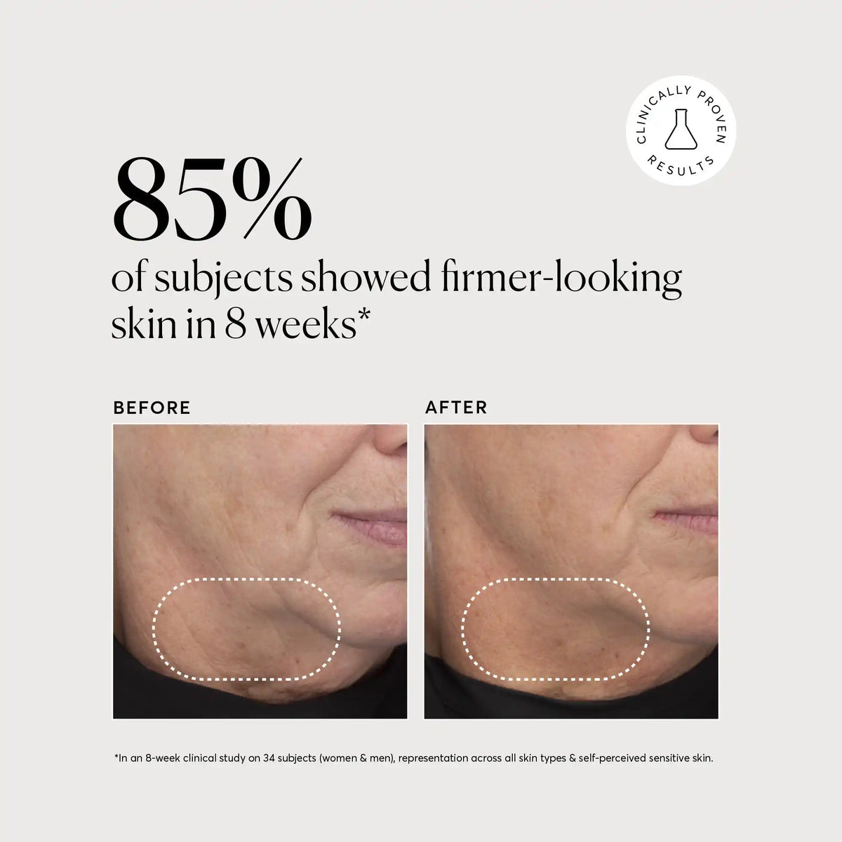 retinol-complex-serum-g6 NATR-10034-Alt-Images-Retinol-Complex-Serum-04.webp